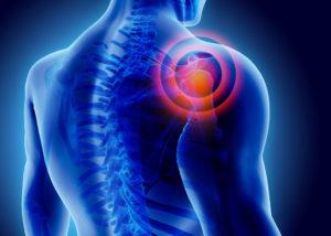 Body Pain After a Car Accident - Shoulder Pain After a Car Accident