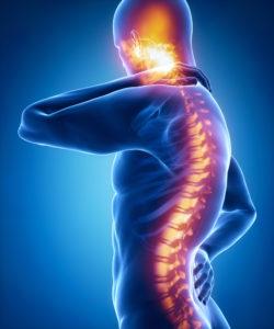 New Orleans LA spinal cord injury lawyer