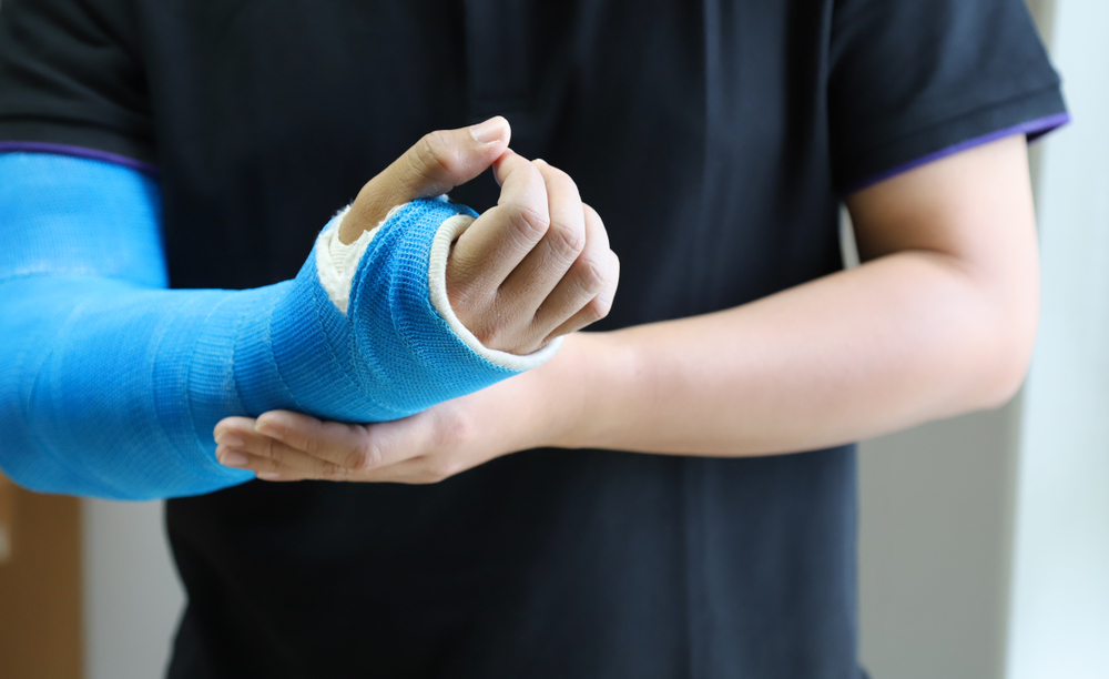 What Is the Average Settlement for a Broken Arm Car Accident